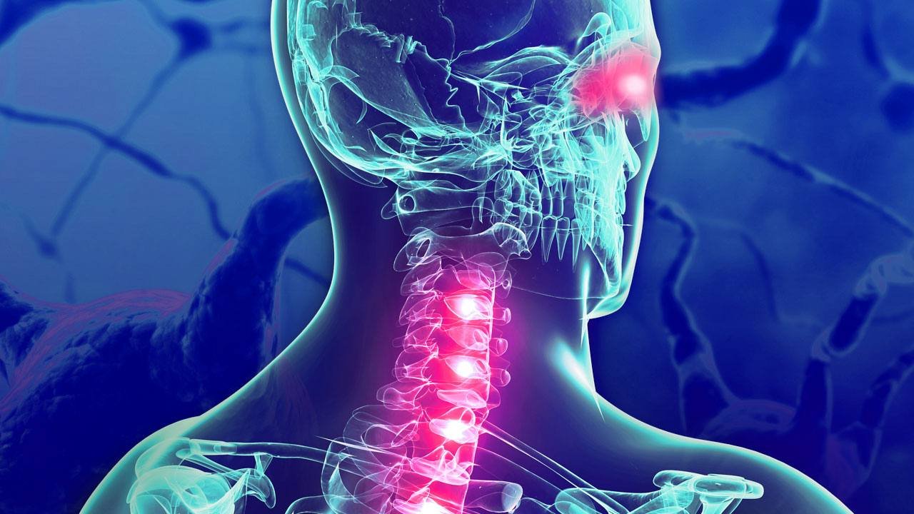 cns demyelinating disease