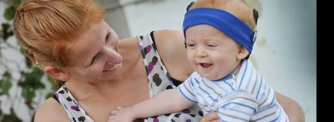 cochlear implant surgery