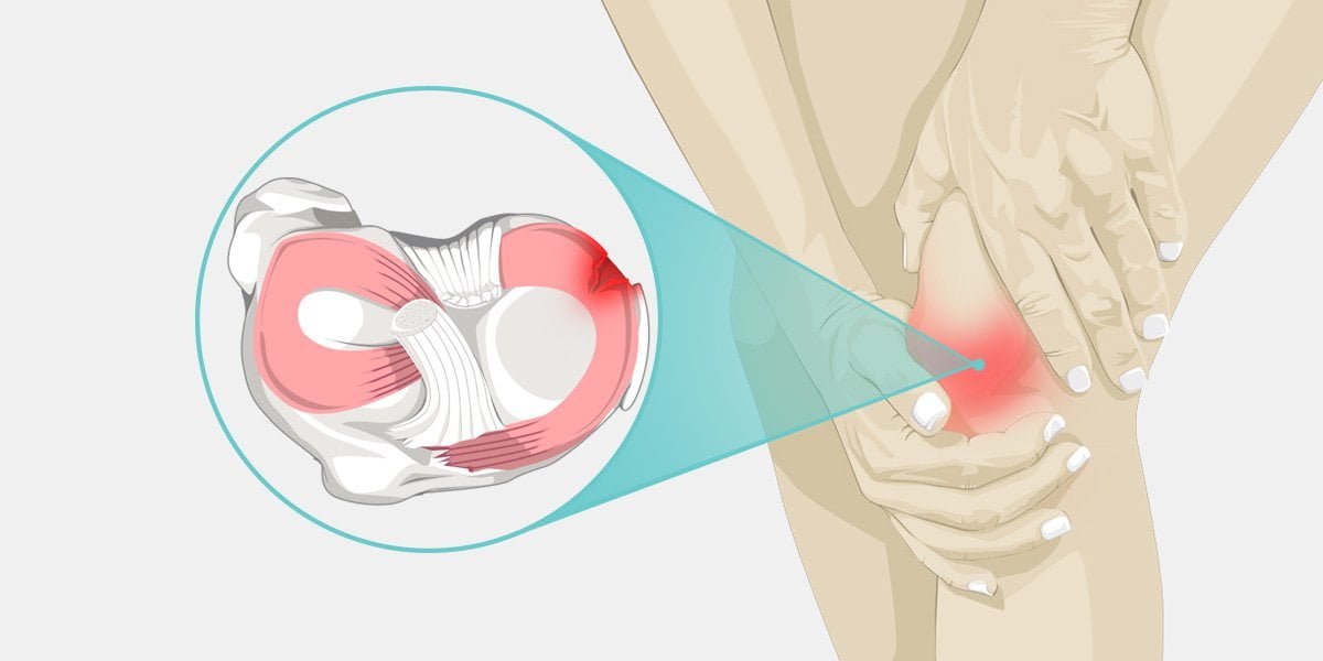 Meniscus