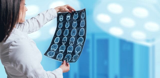 Neurological checkup