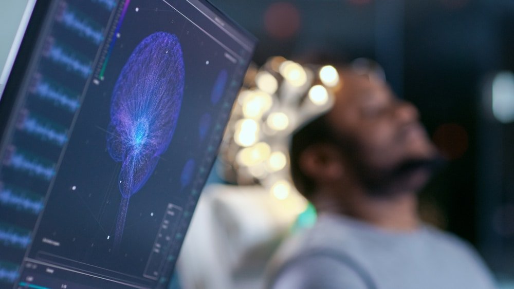 ¿Qué es NeuralCIM y cómo ayuda a proteger el cerebro en la demencia?